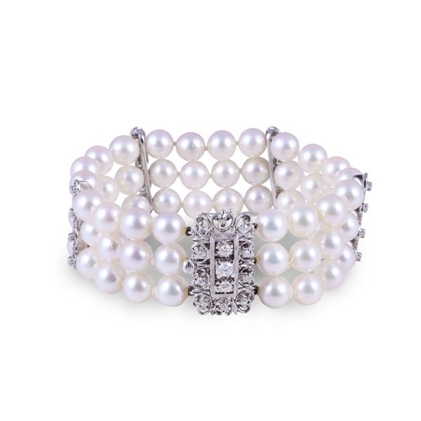 BRACCIALE