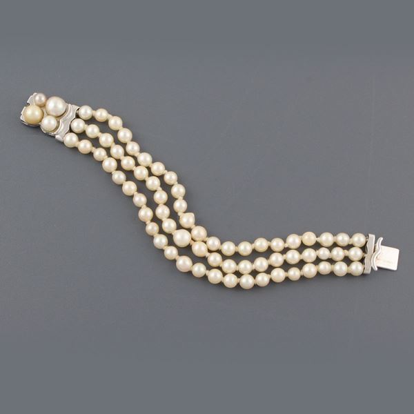 BRACCIALE